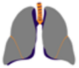 Image of light grey lungs for Grade 3 interstitial lung disease