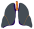 Image of dark grey lungs for Grade 4 interstitial lung disease